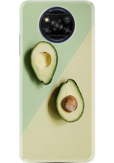 Xiaomi Poco X3 Pro Kılıf Resimli Desenli Baskılı Silikon Dog in the Dress 1364