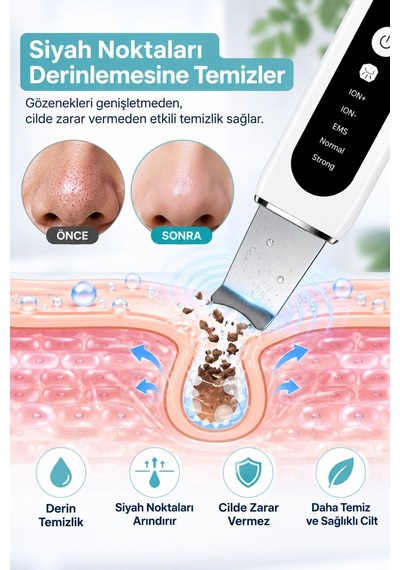 Auhma Ahb-13 Ultrasonik Cilt Temizleme Cihazı 4 Modlu Siyah Nokta Gözenek Temizleyici İyonlu Yüz Pee