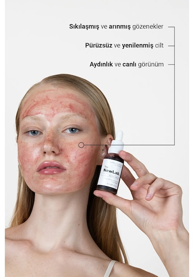 The NewLab Canlandırıcı & Cilt Tonu Eşitleyici Kırmızı Peeling Serum 30 Ml (Aha 10% Bha 2%)