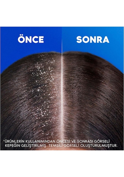 Head & Shoulders İpeksi Yumuşaklık 2'si 1 Arada Kepek Karşıtı 330ml Şampuan