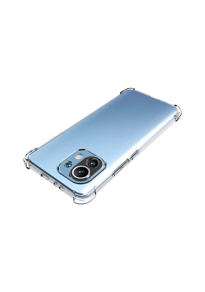 Hepsi Xiaomi Mi 11 Kamera Korumalı Shockproof Darbe Emici Silikon Kılıf- 5775 Najmaddin Şeffaf
