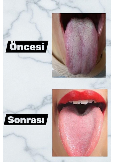 Çelik Dil Temizleyici Dil Sıyırıcı Paslanmaz Çelik Ağız Bakım Fırçası Dil Plak Temizleme Aparatı