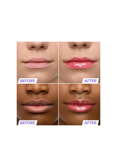 Wonderskin Lip Rehab Nemlendirici Ve Onarıcı Renkli Dudak Serumu Yağı Amour 3.57ml