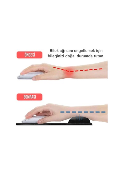 Ankanorm Mouse Pad Bilek Destekli Jel Mouse Pad,ergonomik Kaymaz Taban,oyun Ve Ofis İçin Fare Altlığı,suya Dayanıkl