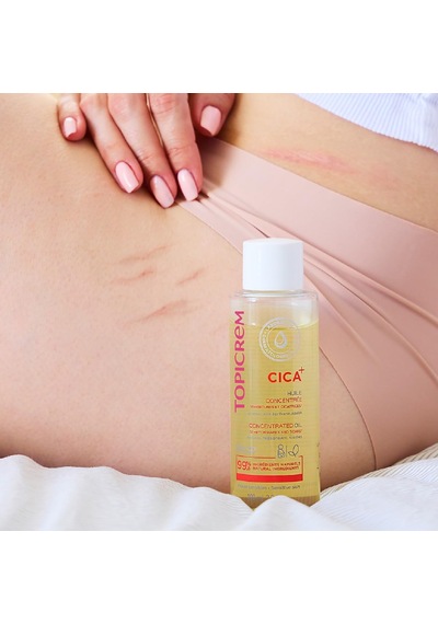 Tr Cıca Concentrated Oil 100 Ml 0.3 ML