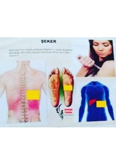 Painless Night Glu 25'li Sağlık Destek Bandı
