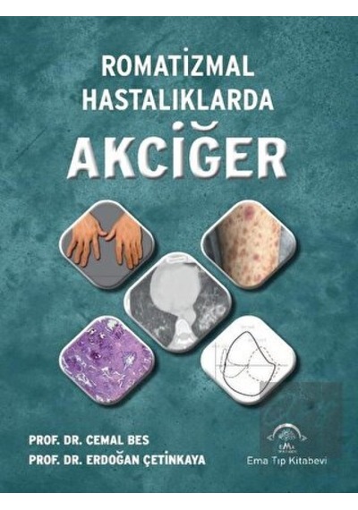 Romatizmal Hastalıklarda Akciğer  - Erdoğan Çetinkaya  -  Cemal Bes  - Ema Tıp Kitabevi