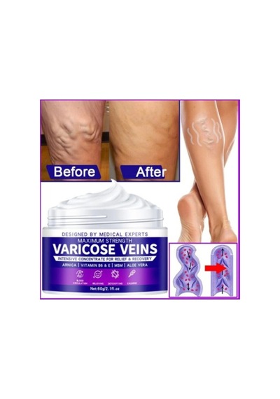 Strength Varicose Vein Tedavi Kremi 100 Ml X 2 Adet