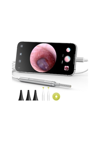 Anykit Dijital Otoskop, Ultra Net Görüşlü Kulak Kamerası - İpad/iphone/android