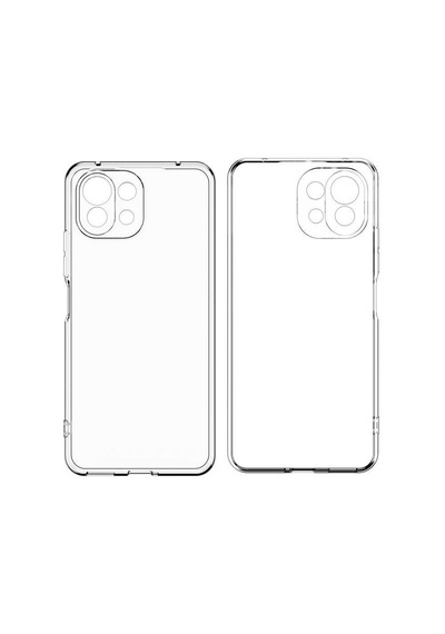 Adige Xiaomi Mi 11 Lite Kılıf Kamera Korumalı Süper Silikon