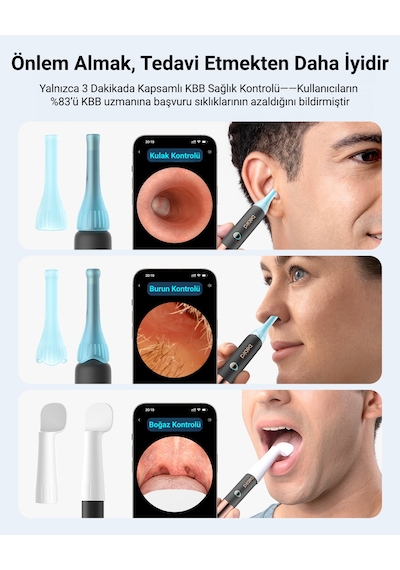 Bebird Earsight Ultra 2k Hd Kameralı Akıllı Kulak Temizleme Cihazı Görüntülü Cımbız Ve Damlalık Seti
