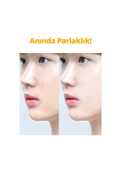 Frankly %5 Niacinamide İçeren Cilt Tonu Eşitleyici Aydınlatıcı Ve Leke Karşıtı Sunday Glow Serum 37 ML