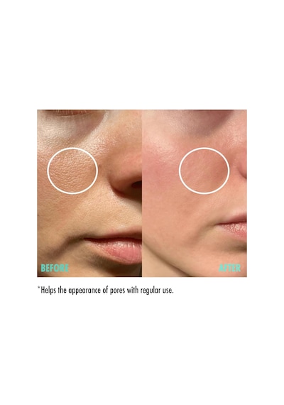 Gözenek Sıkılaştırıcı Cilt Serumu 30 Ml
