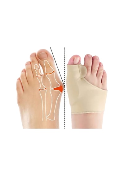 Akestoria Med Baş Parmak Kemik Düzeltici Ve Koruyucu Makarlı Unisex Fc-038 L