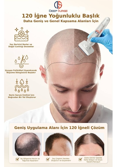 140 Titanyum İğneli Ayarlanabilir İğne Ölçülü 0.25-3.0mm Dermas