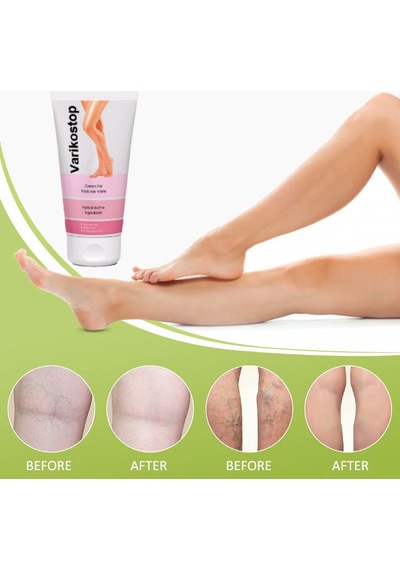 Varikostop Bacak Bakım Kremi 50 Ml