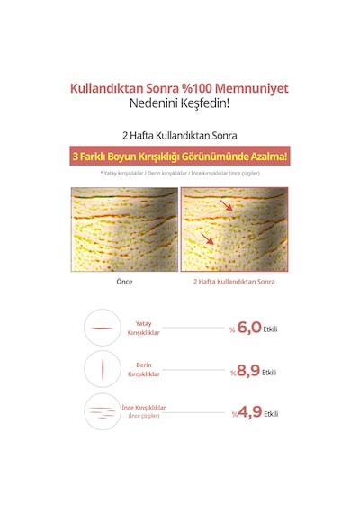 Kırışıklık Karşıtı, Masaj Başlıklı Yüz&boyun Kremi Dermatory Retinal Spicule Wrinkle&neck Cream