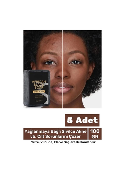 100% Doğal Güzel Kokulu El Yüz Saç Vücut Cilt Onaran Kolajen Etkili Afrika Bitkisel Sabun 5 Adet