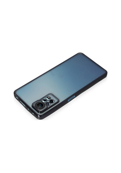 Xiaomi Redmi Note 12 Pro / 11 Pro 4g Kılıf Razer Lens Çerçeveli Silikon Kapak