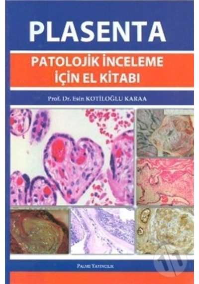 Plasenta Patolojik İnceleme İçin El Kitabı Palme