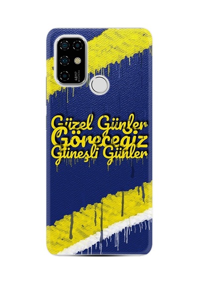Arvencase Casper Via F20 Kılıf Hd Baskılı Kılıf Yüksek Korumalı - /çoksatanlar/- Name-532.jpg Renk15 Renk15