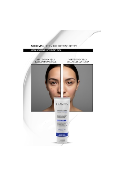 Beyazlatıcı Whitening Krem - Aydınlatıcı Ve Cilt Tonu Eşitleyici 100 Ml Yüzkrem