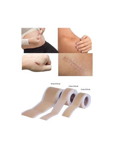 Ayrex Welltape Silikon Yara İzi Giderici Bant, 2 Cm X 1,5 M, Konforlu İz Tedavisi