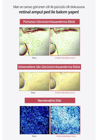 Gözeneklere Sıkı Görünüm Sunan Esnek Yapılı Cilt Bakım Pedi Dermatory Retinal Lifting Ampoule Pad