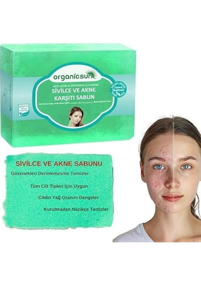 Doğal Akne Ve Sivilce Karşıtı Sabun 140 Gr 1 Adet Tüm Cilt Tipleri İçin Natural Sabun Acı Badem