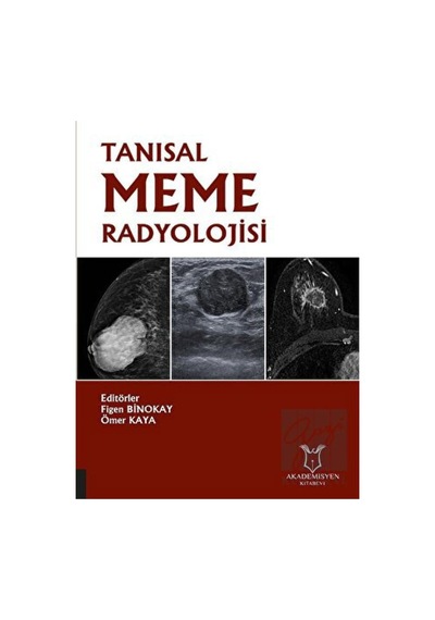 Tanısal Meme Radyolojisi - Akademisyen Kitabevi - Tıp Kitapları