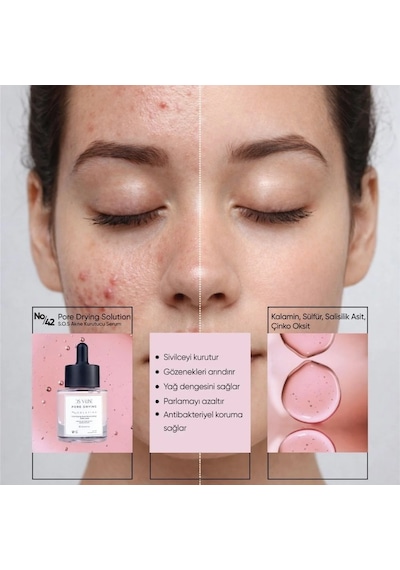 Ds V-Line Sebum Dengeleyici Sulfur Serum 30 ML