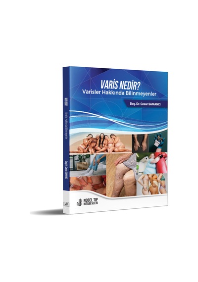 Varis Nedir Varisler Hakkında Bilinmeyenler