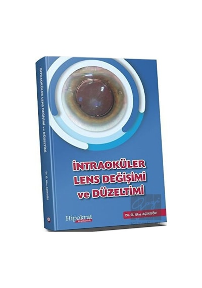 Intraoküler Lens Değişimi Ve Düzeltimi - Hipokrat Kitabevi