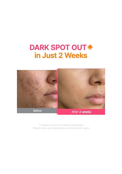 Txa 6 Niacinamide 10 Retinal Serum Leke Karşıtı Aydınlatıcı Yaşlanma Karşıtı Serum 30 Ml