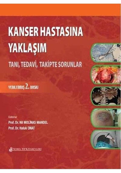 Kanser Hastasına Yaklaşım- Nobel Tıp Kitabevleri
