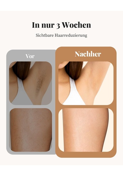 Haarlosy Ipl Cihazları Evde Salon Kalitesinde Uzun Süreli Sonuçlar Veren Kadınlar Ve Erkekler İçin Epilasyon Lazeri, Yüz, Bikini Bölgesi Ve Vücut İçin Ağrısız Ipl Epilasyon Cihazı Haarlosy Ipl Cihazları Evde Salon Kalitesinde Uzun Süreli Sonuçlar Veren Kadınlar Ve Erkekler İçin Epilasyon Lazeri, Yüz, Bikini Bölgesi Ve Vücut İçin Ağrısız Ipl Epilasyon Cihazı