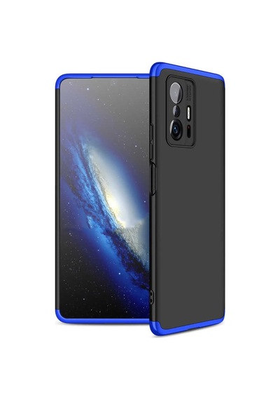 Xiaomi Mi 11T 5G Kilif Zore Ays Full Koruma Kilif 532707488