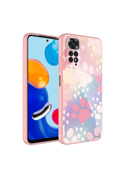 Xiaomi Redmi Note 11s Global Kılıf Kamera Korumalı Desenli Sert Silikon Zore Epoksi Kapak NO4