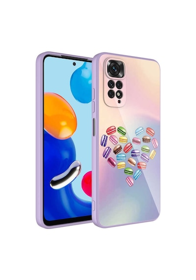 Zore Redmi Note 11 Global Kılıf Kamera Korumalı Desenli Sert Silikon Ogaa Epoksi Kapak - No1