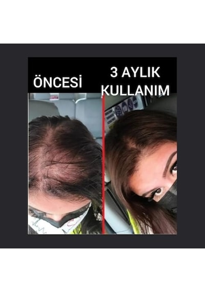 Ayrex Dermanew Saç Büyüme Serumu, Hair, 50 Ml, 10'lü Set - Hair