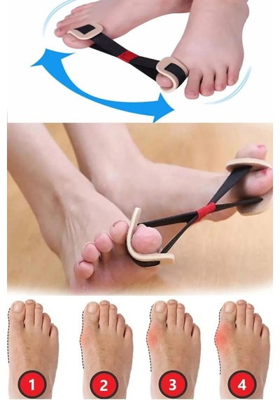 Ayak Baş Parmak Egzersiz Lastiği Hallux Valgus Bunyon Düzeltici Güçlendirici Aparat - 850294370