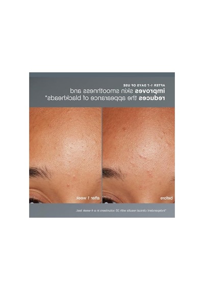Günlük Mikrofolyant 13g, Cilt Yenileyici Peeling