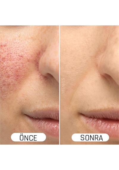 Vitayes Vitamin C + Hyaluronik Asit Serum 2 x 30 ML