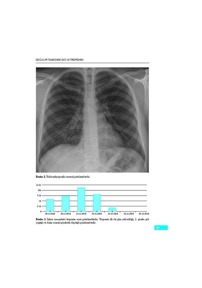 Olgular Temelinde Ekg Ve Troponin