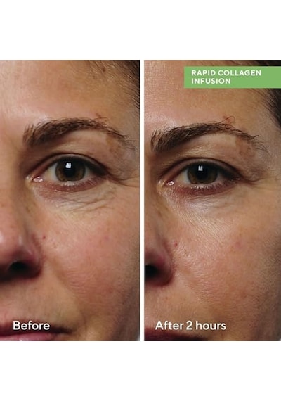 Murad Collagen Infusion Anında Sıkılaştırıcı Kolajen Serumu 30 Ml