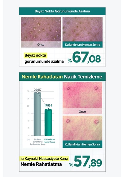 Sebumu Arındıran Siyah Nokta Ve Gözenek İçin Kil Temizleme Köpüğü Dermatory Salicinic Pore Clay Foam