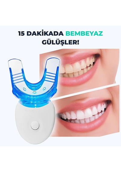 5 Led Işıklı Diş Beyazlatma Cihazı Ve 3 Adet Jel Seti