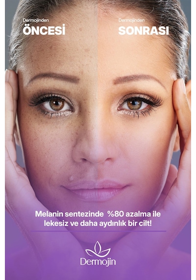 Leke Karşıtı Ve Aydınlatıcı Cilt Bakım Serumu 30 Ml