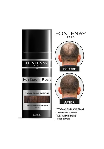 Fontenay Saç Dolgunlaştırıcı Keratin Fibers Orta Kahve Topik Saç Tozu 50gr + Saç Spreyi 2'li Set