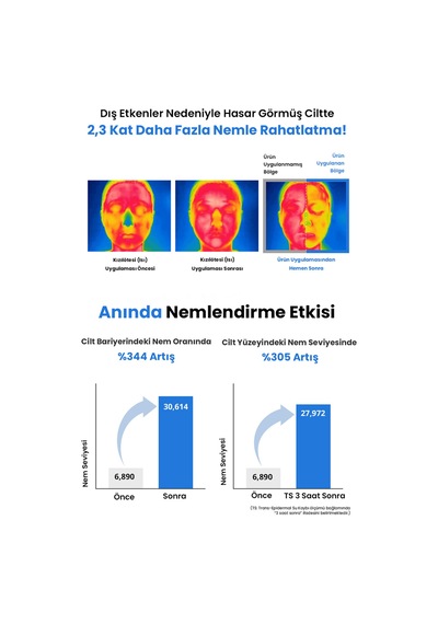 Hassas Cilt Bariyerini Destekleyen Ve Yoğun Nem Desteğiyle Rahatlatan Krem Zeroıd Soothing Cream